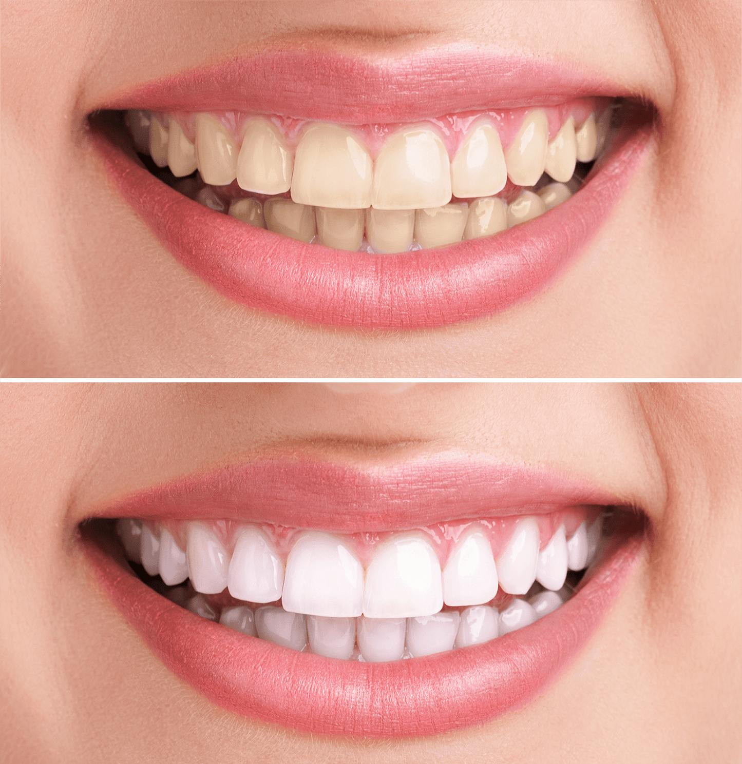 Lumira™ Advanced Whitening Pen
